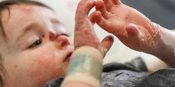 ۸۰ درصد بیماری‌های نادر، ژنتیکی است