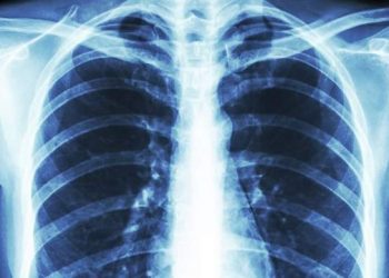 ریه بیماران کُرونایی به حالت عادی بر می گردد؟