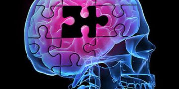 شناسایی ۱۰ فاکتور پرخطر مرتبط با آلزایمر