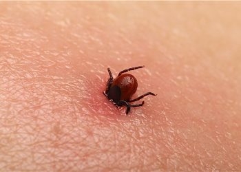 موارد مشکوک به تب کریمه کنگو در گیلان به ۲۵ نفر رسید