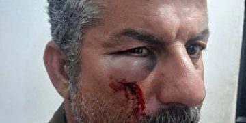 حمله قاچاقچیان چوب به ماموران یگان حفاظت منابع طبیعی شفت