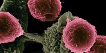 معرفی شایع‌ترین سرطان‌ها در گیلان