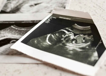 سالانه بیش از ۴۰۰ هزار سقط جنین در ایران